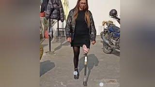 The beautiful amputee woman challenges disability with an artificial leg #ampute