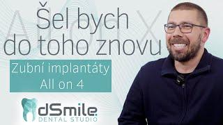 Moderní řešení zubních náhrad: All on X v Praze  #implant #dentist #dsmile  #allon4dentalimplants