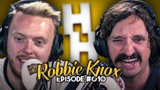 ROBBIE KNOX | Having Testicles Removed, Locked in a Room with Noel Gallagher & Soccer AM