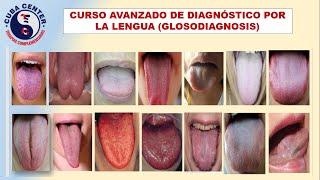 CURSO AVANZADO DE DIAGNÓSTICO POR LA LENGUA