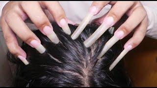 ASMR [25 MIN] Fast Scratch Itchy Scalp, Satisfying Scalp Scratching * No Talking *