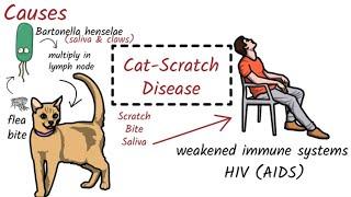 Cat-scratch Disease: Causes, Symptoms, Diagnosis, Treatmen, Prevention