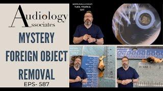 MYSTERY FOREIGN OBJECT REMOVAL - EP587