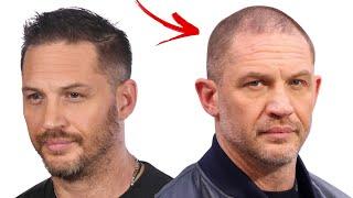 Tom Hardy Is Going Bald Fast