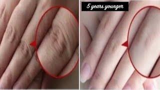 how to make your hands look 5 years younger in 2 mins, wrinkle free formula