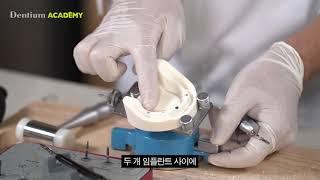 Implant Surgery 박주부의 수술비책 - 릿지 스프레더 Ridge spreader 덴티움