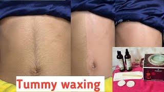 Full growth hair tummy waxing by rica wax #waxingtips #ricawax #skin #tummywax ​⁠@pummybeautyworld