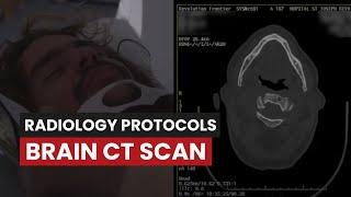 CT Scan of the Brain Without Contrast: A Protocol Guide for CT Techs