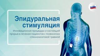 Эпидуральная стимуляция: Инновационная процедура пациентов с позвоночно -спинномозговой травмой