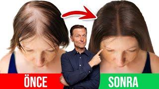Saç Dökülmesini Önlemek İçin 5 En İyi Tavsiye | Dr.Berg Türkçe