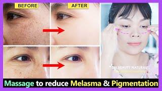 Massage to reduce Hyperpigmentation, Melasma, Freckles, Uneven skin tone to fade quickly.