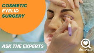 Cosmetic Eyelid Surgery: What to Know About Blepharoplasty | Ask the Experts | Sharecare