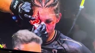 BRUTAL cut from Headbutt!!!   UFC Sphere #aldana #gross #mma #crazy #dumont #gnarly