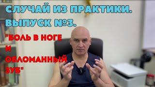 Случай из практики. Выпуск №3. "Боль в ноге и обломанный зуб"