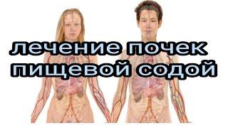 Treatment of kidneys with soda. Ethnoscience. Experiment. Professor. Doctor. Academician. Scientist.