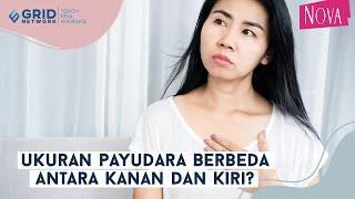 Kenapa Ukuran Payudara Berbeda antara Kanan dan Kiri?