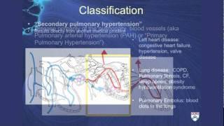 Pulmonary Hypertension: A challenging cause of shortness of breath