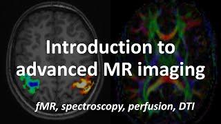 An Introduction to Advanced MRI techniques: fMRI, spectroscopy, perfusion & diffusion tensor imaging