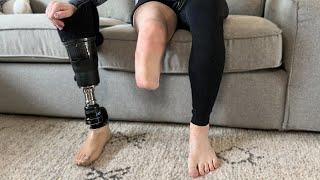 Removing my prosthetic leg terrifies me