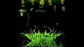 Gore Gore Gadget - Annotations Of An Autopsy