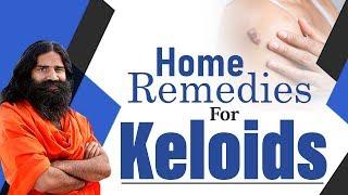 Home Remedies For Keloids | Swami Ramdev