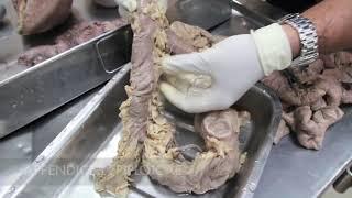 Anatomy Dissection of Large & Small Intestine