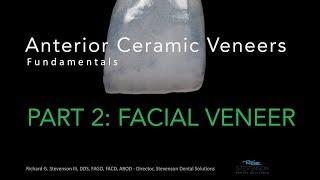 Anterior Ceramic Veneers, Part 2: Facial Veneer