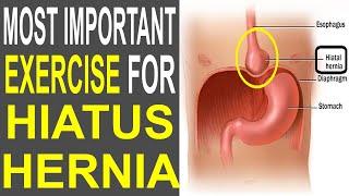 Most Important Exercise To Cure Hiatus Hernia | HEALTH MADE EASY