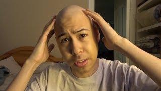 I'm Bald! - Half Way Through Chemotherapy