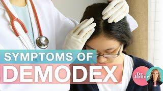 Symptoms Of Demodex Parasites | Dr. J9 Live