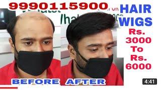 Hair wigs in delhi | Rs. 5000 . 9990115900 . Hair wigs shop in delhi | Hair wigs Wholesale