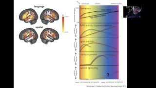 8 Brain Plasticity