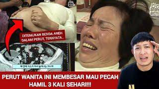 WANITA INI HAMIL 3X DALAM SEHARI !! TERUNGKAP ISI DIDALAM PERUTNYA SANGAT MENGERIKAN, TERNYATA..!!