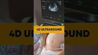 ️️4d ultrasound during pregnancy |  Pravi hospital | Best Gynae Doctor in Kanpur