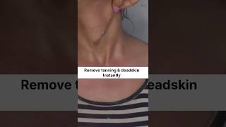 Suntan & deadskin remover in minutes #shorts #skincare