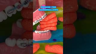 CANDY YOU CAN EAT WITH BRACES  SHARK WEEK  ORTHODONTIST REACTS SATISFYING CANDY FOOD ASMR