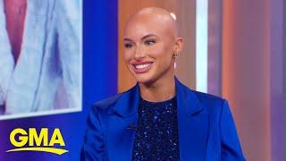 TikTok star Chloe Bean talks alopecia journey