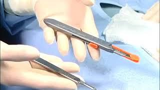 SANDEL® - Safety Scalpels - Ansell Medical