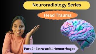 Extra-axial Hemorrhages |  Head Trauma Part 2 | Neuroradiodiology |  Dr Somlina  Dutta