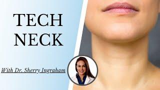 TECH NECK | Dr. Sherry Ingraham Discusses Tech Neck and Prevention