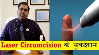 Laser Circumcision से हो सकता है जबरदस्त नुकसान | Laser Circumcision Complications in Hindi