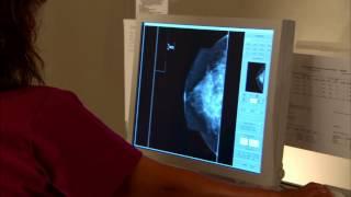 Understanding Radiology: Three Types of Biopsy