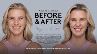 My BOTOX® Cosmetic & JUVÉDERM® Collection Treatment Journey | BEFORE & AFTER