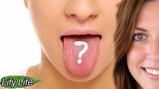 Mirror Test: How the Appearance of Your Tongue Can Reveal Serious Health diagnosis