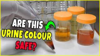 What your Urine Colour Says About Your Health