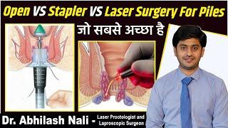 Piles Treatment || Open vs laser vs stapler Surgery For Piles || बवासीर का इलाज || Dr Abhilash Nali