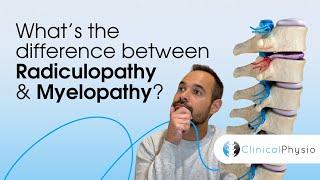 What’s the difference between Radiculopathy and Myelopathy? | Expert Physio Guide