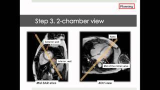Why CMR Webinar: Introduction into scanning and planning for CMR