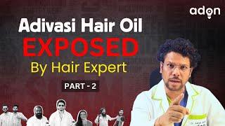 Adivasi Hair Oil KA ASLI SACH | Scam Exposed by Hair Expert -  watch before you buy adivasi hair oil