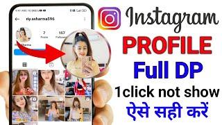 Instagram profile picture zoom not working problem fix | Instagram profile pic 1 click not open